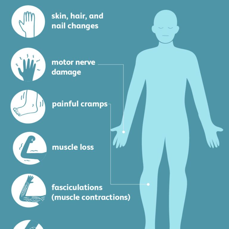 Peripheral Neuropathy Types Causes Symptoms Treatment 